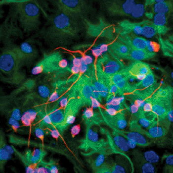 Image: Differentiated neural stem cells (Photo courtesy Dr. Paul Knoepfler, UC Davis).